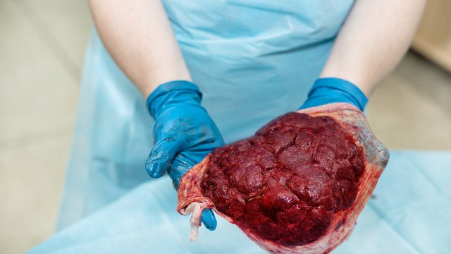 Qu'est-ce que le placenta?