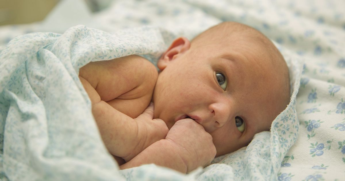 Tout Savoir Sur Les Petits Boutons De Bebe