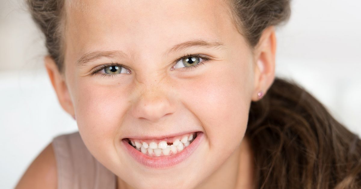 La Perte Des Dents De Lait