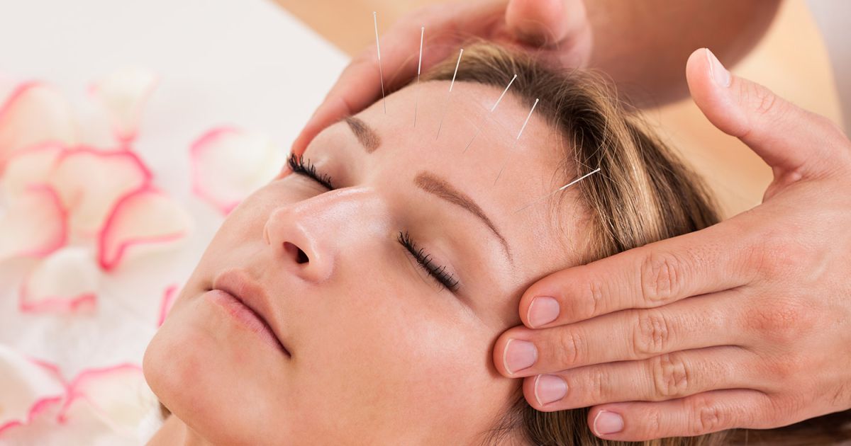 L'acupuncture pour soulager les nausées de grossesse Grossesse